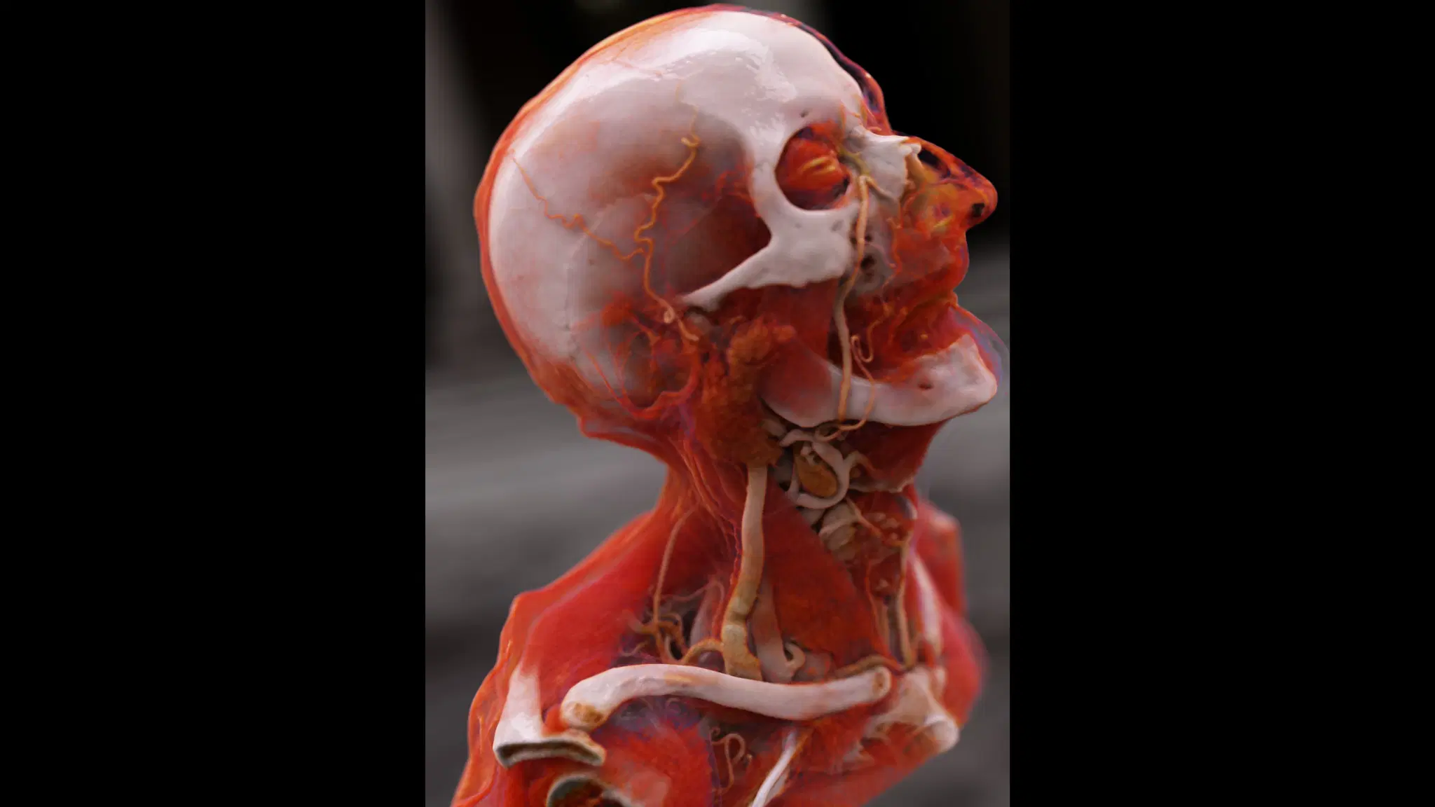 Cinematic Rendering example from Siemens Healthineers page